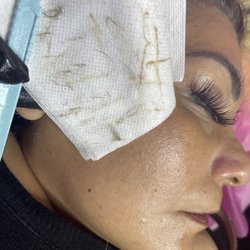 The Chick Spot - DERMAPLANE FACIAL