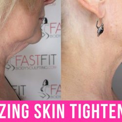 Fast Fit Body Sculpting - Fast Fit Body Sculpting Fat Weight Loss Review Before and After Skin Tightening