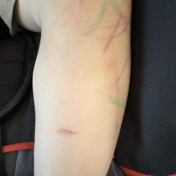 All Aboard Academy - Came home covered in markers one day. That's the cut from the fence. - Preschools Near Me - Spring Hill, Florida All Aboard Academy - Came home covered in markers one day. That's the cut from the fence. - Preschools Near Me - Spring Hill, Florida