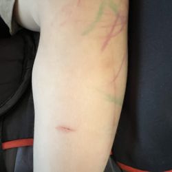 All Aboard Academy - Came home covered in markers one day. That's the cut from the fence.