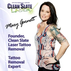 Removery Tattoo Removal and Fading