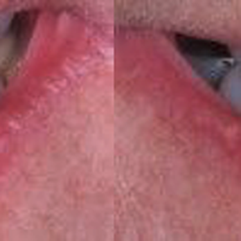 Lifetime Dental - Before & After at Lifetime Dental | Boerne, TX - General Dentistry Near Me - Boerne, Texas Lifetime Dental - Before & After at Lifetime Dental | Boerne, TX - General Dentistry Near Me - Boerne, Texas