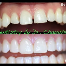 Advanced Aesthetic & Implant Dentistry