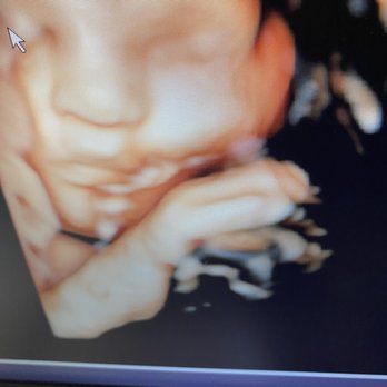 Babys First Impression - Ultrasound Imaging Centers Near Me - Fort Worth, Texas Babys First Impression - Ultrasound Imaging Centers Near Me - Fort Worth, Texas