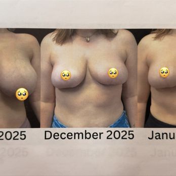 Coastal Cosmetic Center - Before and After - Cosmetic Surgeons Near Me - Jacksonville, Florida Coastal Cosmetic Center - Before and After - Cosmetic Surgeons Near Me - Jacksonville, Florida