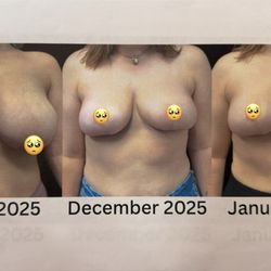 Coastal Cosmetic Center - Before and After
