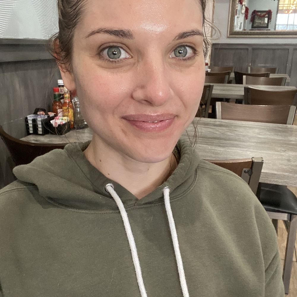 Hand & Stone Massage and Facial Spa - My skin right after my facial with Christina. - Massage Near Me - Huntington Beach, California Hand & Stone Massage and Facial Spa - My skin right after my facial with Christina. - Massage Near Me - Huntington Beach, California