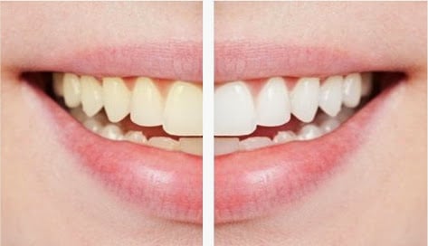 Masterpiece Smiles - sleep specialist in Ellisville, MO