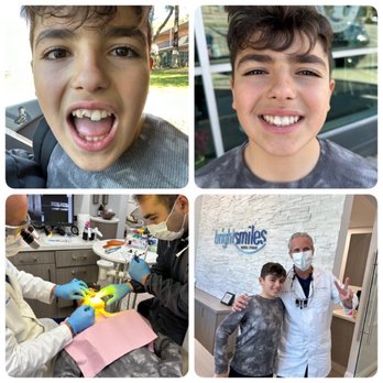 Bright Smiles Dental Studio - Here is a before and after of my boy. Thank you Dr Garcia - General Dentistry Near Me - Glendale, California