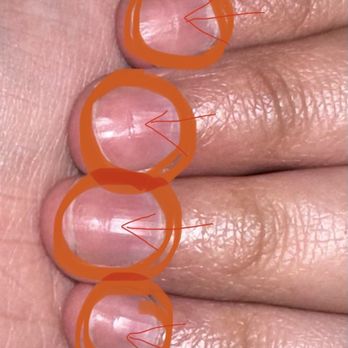 TN Nails and Spa - Dents from the over buffing - Nail Technicians Near Me - Orlando, Florida TN Nails and Spa - Dents from the over buffing - Nail Technicians Near Me - Orlando, Florida