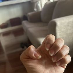 This a picture of the awful manicure