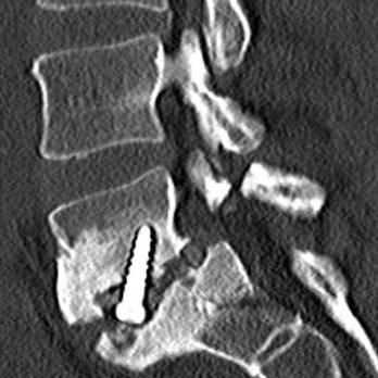 Madeira Chiropractic Wellness Center - Look what we found inside this spine! - Chiropractors Near Me - Hershey, Pennsylvania Madeira Chiropractic Wellness Center - Look what we found inside this spine! - Chiropractors Near Me - Hershey, Pennsylvania