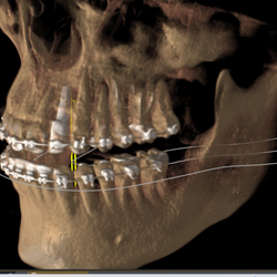 Cobain Orthodontics - Same story in 3d