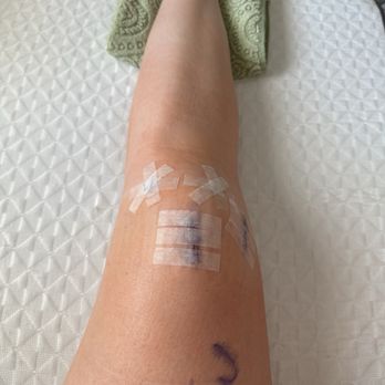 Desert Orthopedic Center - Surgical site w/ Diltz signature. - Orthopedists Near Me - Rancho Mirage, California Desert Orthopedic Center - Surgical site w/ Diltz signature. - Orthopedists Near Me - Rancho Mirage, California