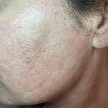 Skin Tight MedSpa - Medical Spas Near Me - Natick, Massachusetts
