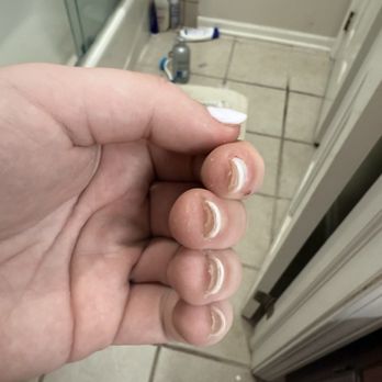 312 Nails & Spa - Nail glue stuck to skin - Nail Salons Near Me - Wheeling, Illinois