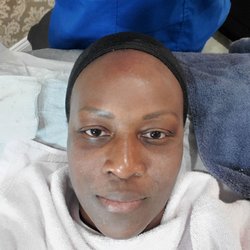 After entire face had been through dermaplaning. NEW SKIN, WHO DIS?