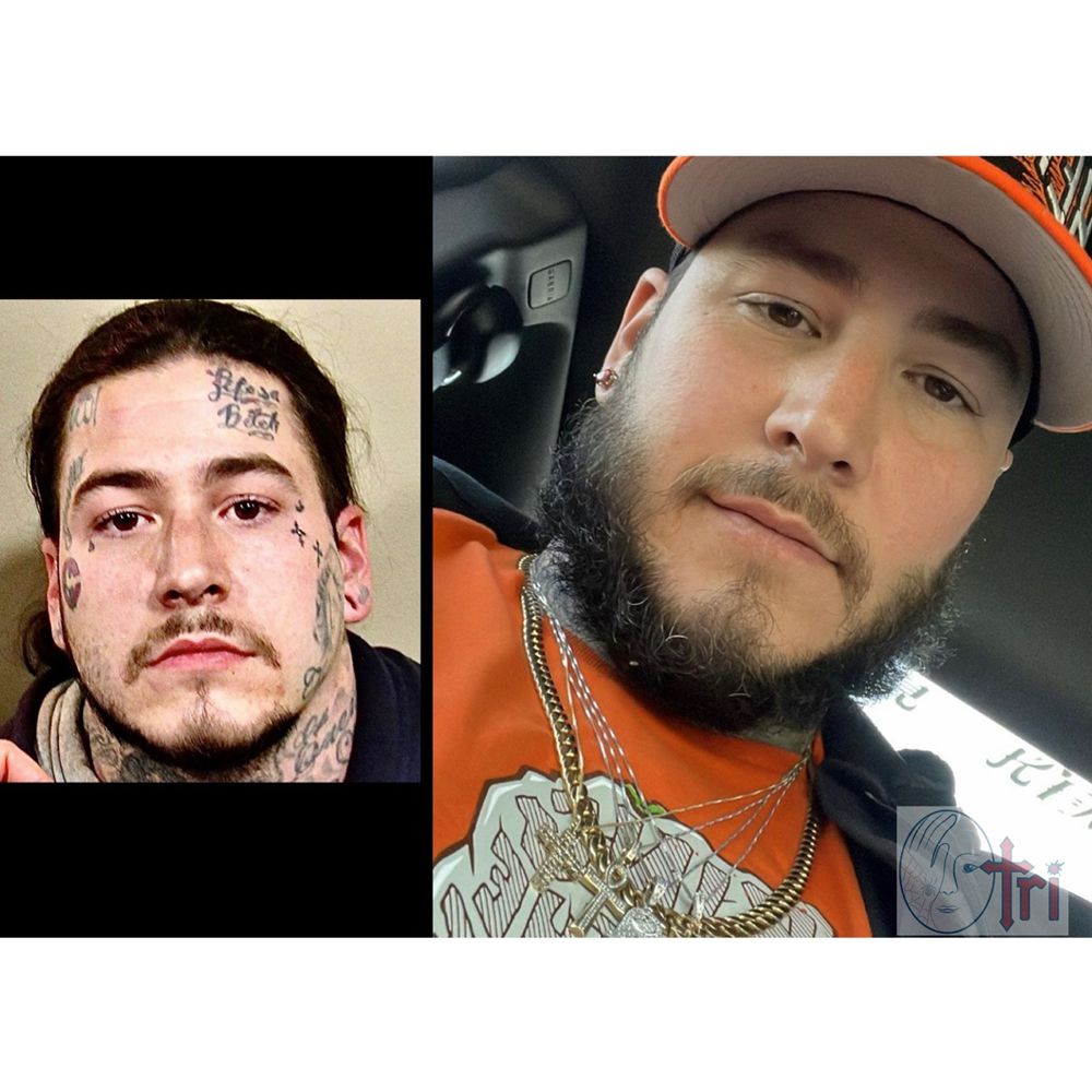 TATTOO REMOVAL INK Updated September 2024 12 Photos 20 West 18th