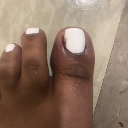 Big toe