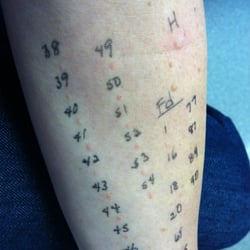 Allergy & Asthma Specialty Service, P.S. - Got poked today! Dr. Brown was informative & Mrs. Seed was a sweetheart!