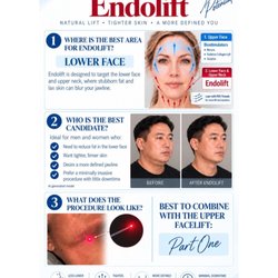 Skin Perfect Brothers - Introducing Endolift