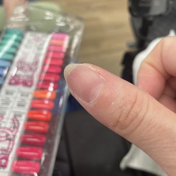 P I Nail Spa - 2 people thinned and shaped my nail like this! It was a nice full nail before this!!! - Nail Salons Near Me - Downey, California P I Nail Spa - 2 people thinned and shaped my nail like this! It was a nice full nail before this!!! - Nail Salons Near Me - Downey, California