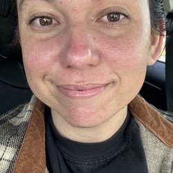 Revival Esthetics - Directly after facial