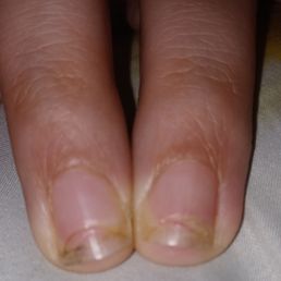 Over field my nails!!! Horrible experiences