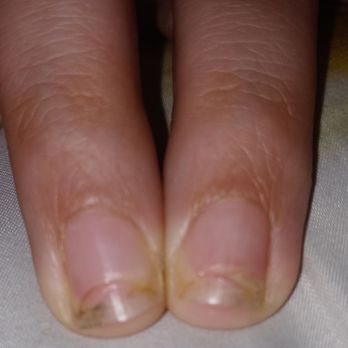 California Nails - Over field my nails!!! Horrible experiences - Nail Salons Near Me - Moline, Illinois