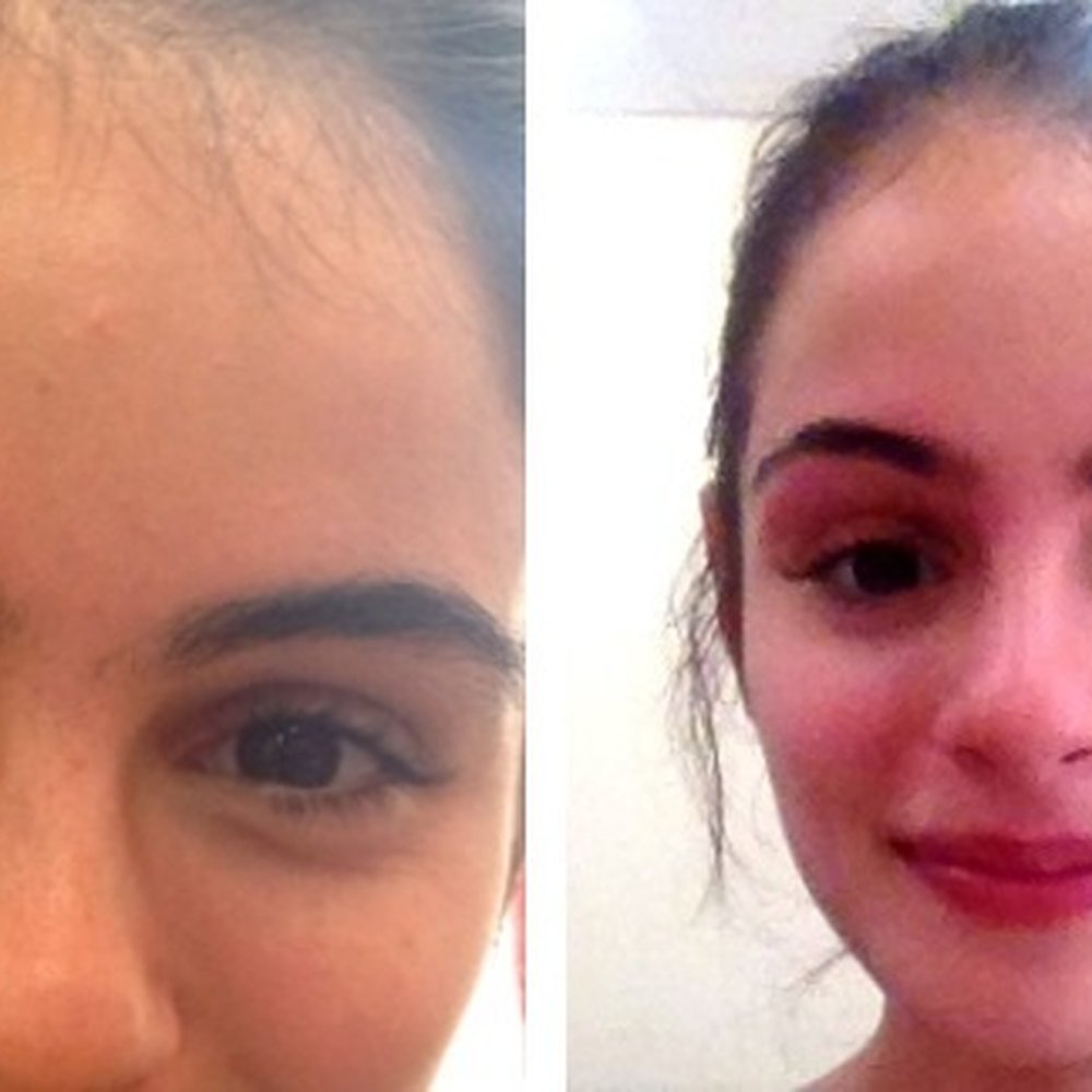 City Eyebrow Threading - A before and after photo so you can see her superb work. Unfortunately, (1) sweltering heat + (2) no makeup = awful picture. ;) - Threading Services Near Me - New York, New York City Eyebrow Threading - A before and after photo so you can see her superb work. Unfortunately, (1) sweltering heat + (2) no makeup = awful picture. ;) - Threading Services Near Me - New York, New York