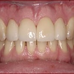 Bridle Trails Family Dentistry - Kirkland