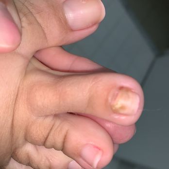 ILASH NAIL SPA - I only go there and now I got a fungus. They cut me. Workers there for the most part dont care about u. - Nail Salons Near Me - Margate, Florida ILASH NAIL SPA - I only go there and now I got a fungus. They cut me. Workers there for the most part dont care about u. - Nail Salons Near Me - Margate, Florida