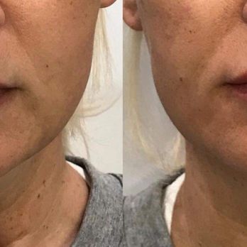 Contour You - Contour You - Medical Spas Near Me - Scottsdale, Arizona Contour You - Contour You - Medical Spas Near Me - Scottsdale, Arizona