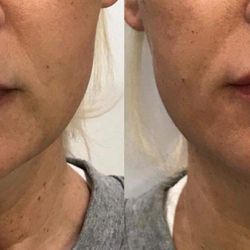 Contour You - Contour You