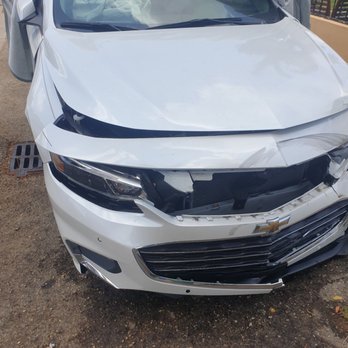 Steinger, Greene & Feiner - This is what they left me with,and I almost got killed,these Lawyers will say anything to get you to hire them,then they leave you DRY !! - Personal Injury Law Near Me - Fort Lauderdale, Florida