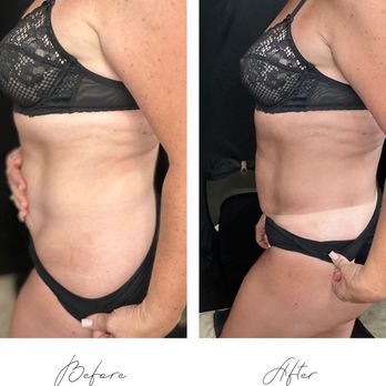 GlowMobile - Spray Tanning Near Me GlowMobile - Spray Tanning Near Me