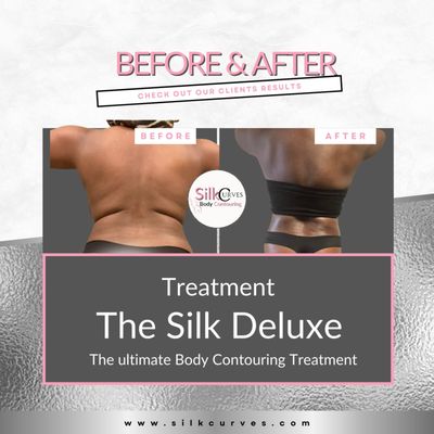Silk Curves Body Contouring