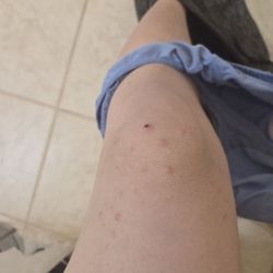 Jun Yang, MD - What should i do with this