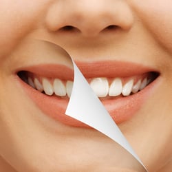 Parkview Dental Vancouver - COSMETIC DENTISTRY VANCOUVER