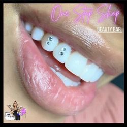 Tooth Gems
