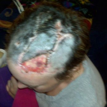 Renaissance Plastic Surgery - 7 year's ago - Cosmetic Surgeons Near Me - Plano, Texas