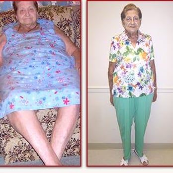 Destination Weight Loss - Linda lost 131 pounds - Weight Loss Centers Near Me - Albertville, Alabama Destination Weight Loss - Linda lost 131 pounds - Weight Loss Centers Near Me - Albertville, Alabama