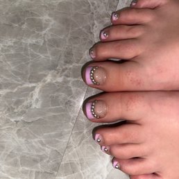 Pedicure