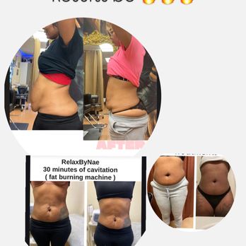 Relax By Nae - Body sculpting
Cavitation + RF Vacuum Therapy lymphatic rub - Body Contouring Near Me - Carson, California Relax By Nae - Body sculpting
Cavitation + RF Vacuum Therapy lymphatic rub - Body Contouring Near Me - Carson, California
