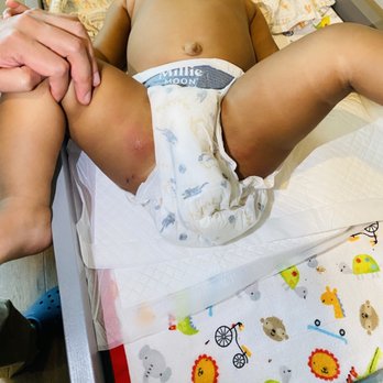 The Goddard School of Decatur - Injuries my daughter came home with from daycare that no one told us about. - Preschools Near Me - Decatur, Georgia