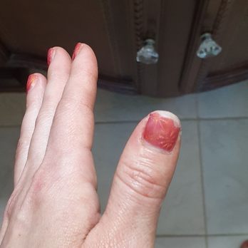 Candle Nail Bar - Just after one week. This was supposed to be gel it is flaking off and coming off. - Day Spas Near Me - Fayetteville, North Carolina Candle Nail Bar - Just after one week. This was supposed to be gel it is flaking off and coming off. - Day Spas Near Me - Fayetteville, North Carolina