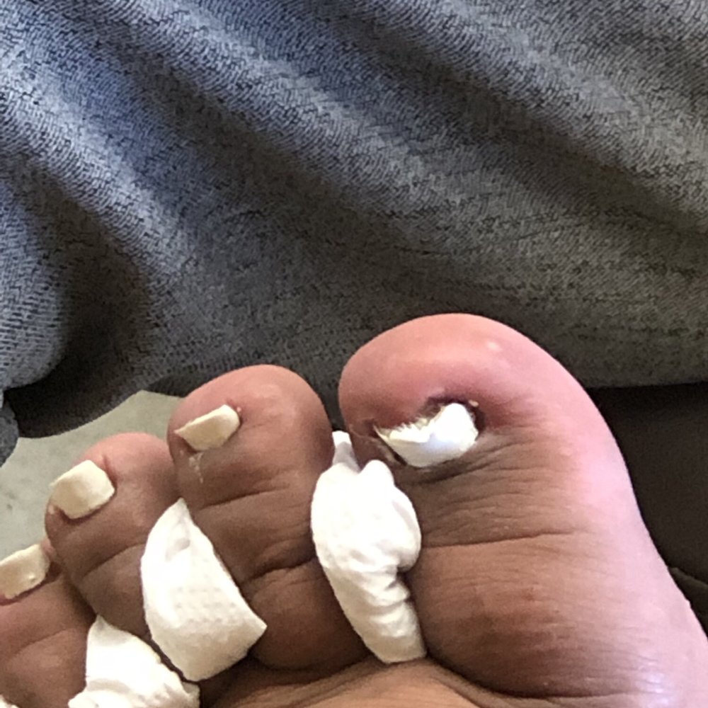 Special Nail - Uneven nail cut and horrible paint job - Nail Salons Near Me - Santa Ana, California Special Nail - Uneven nail cut and horrible paint job - Nail Salons Near Me - Santa Ana, California