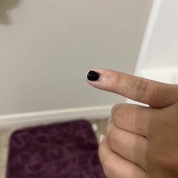 My 2 pinky's are chopped after like 12 days My 2 pinky's are chopped after like 12 days