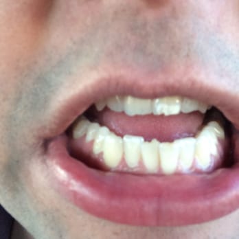 Princeton Premier Dental - General Dentistry Near Me - Princeton Junction, New Jersey