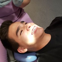 Ortodoncia Dr. Federico Berlanga - Getting braces put on.